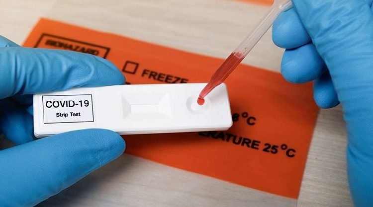 6000 Lab tests being done in SMHS Hospital on daily basis