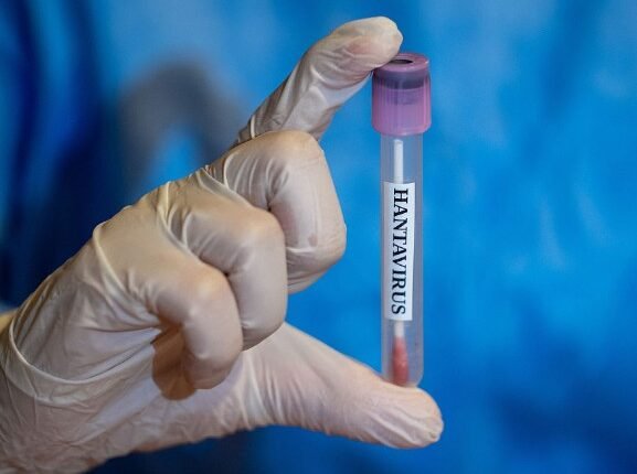 US Health Officials Monitor Two Possible Mild Hantavirus Cases