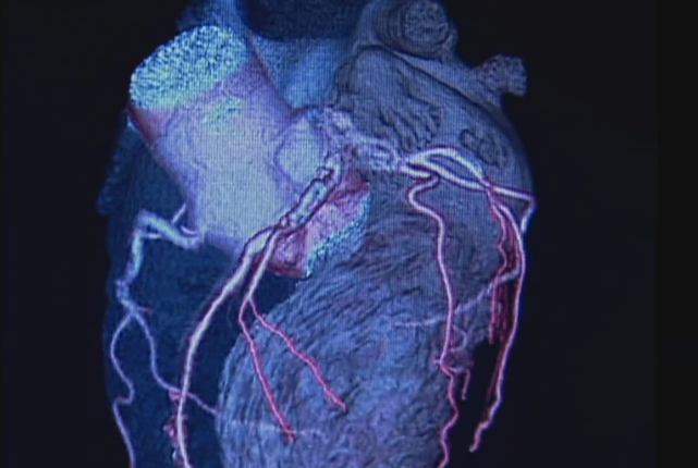Heart Health Takes Centre Stage as Experts Highlight Earlier Risk Detection