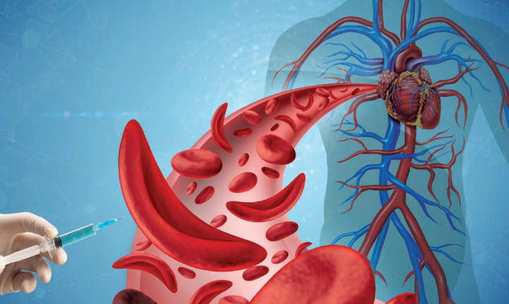India’s Sickle Cell Fight Faces New Challenge: Ensuring Continuous Care After Screening
