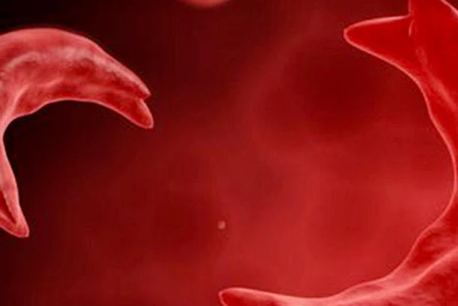 India’s Sickle Cell Programme Faces Next Challenge: Ensuring Continued Care After Screening